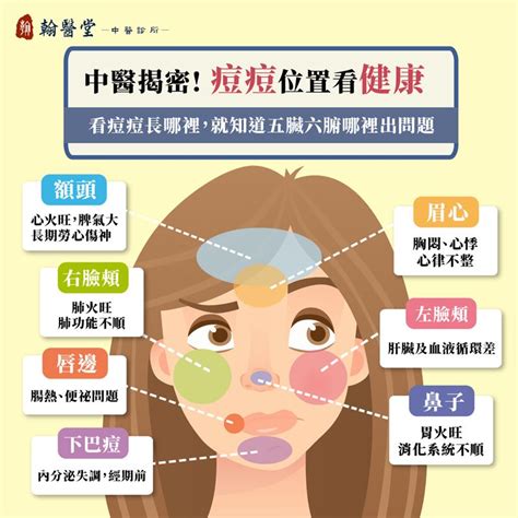 上唇長痘痘|眉毛、人中長痘痘的原因？10個「青春痘位置」對應你。